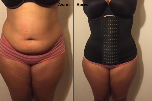 Corsets minceur